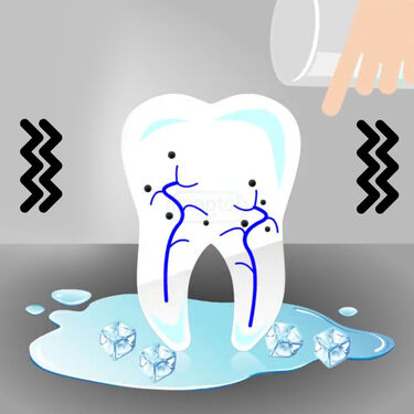 Instant Sensitivity Tooth Paste (OCTP1)