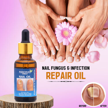 Nail Fungus & Infection Repair Oil