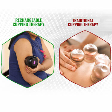 Rechargeable Cupping Therapy for Pain Relief (PRS66)