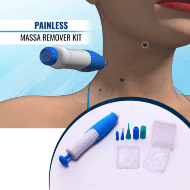 Painless Massa Remover Kit (WR2)